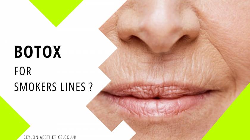 blog post botox smokers lines anti wrinkle injections